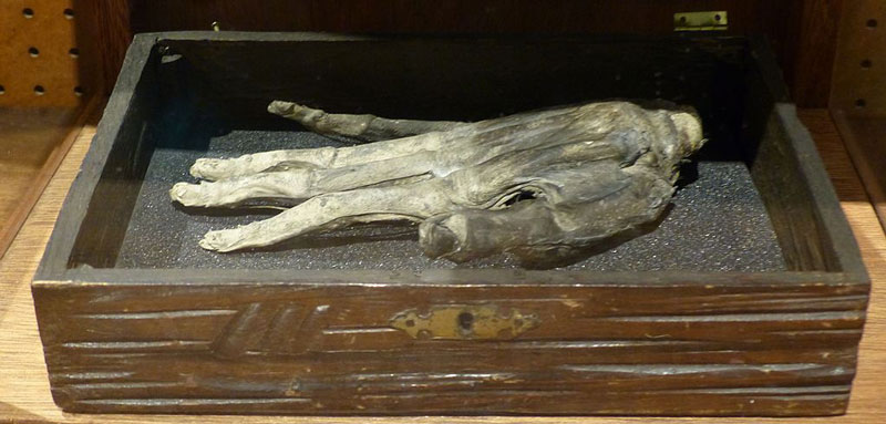Hand of Glory, Whitby Museum, Yorkshire